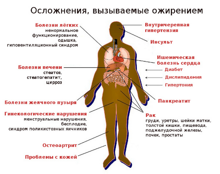 Ожирение печени, стеатоз — лечение